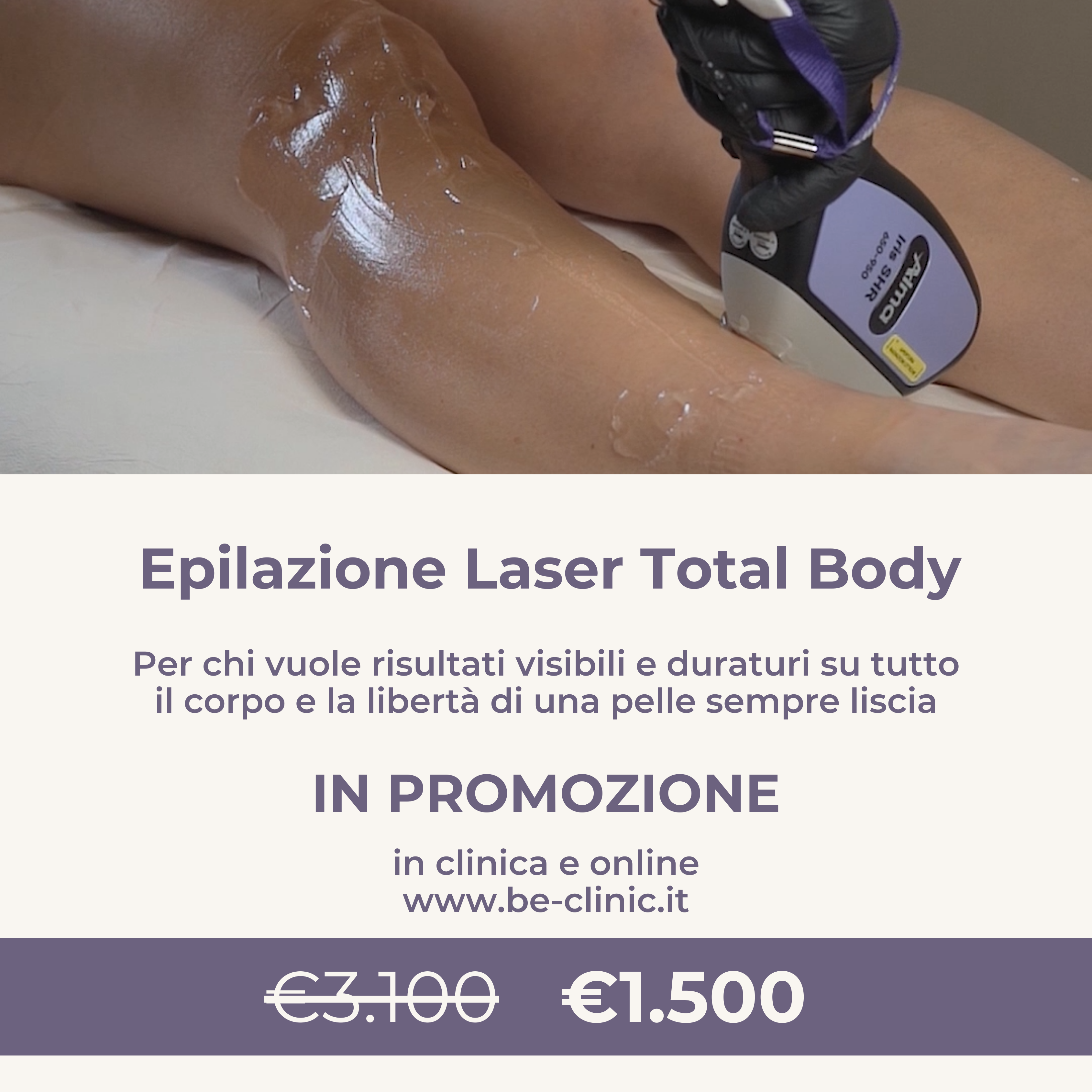 Epilazione Laser Total Body