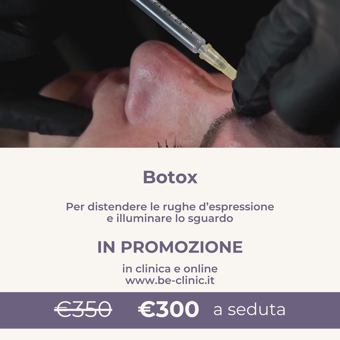 Trattamento BOTOX