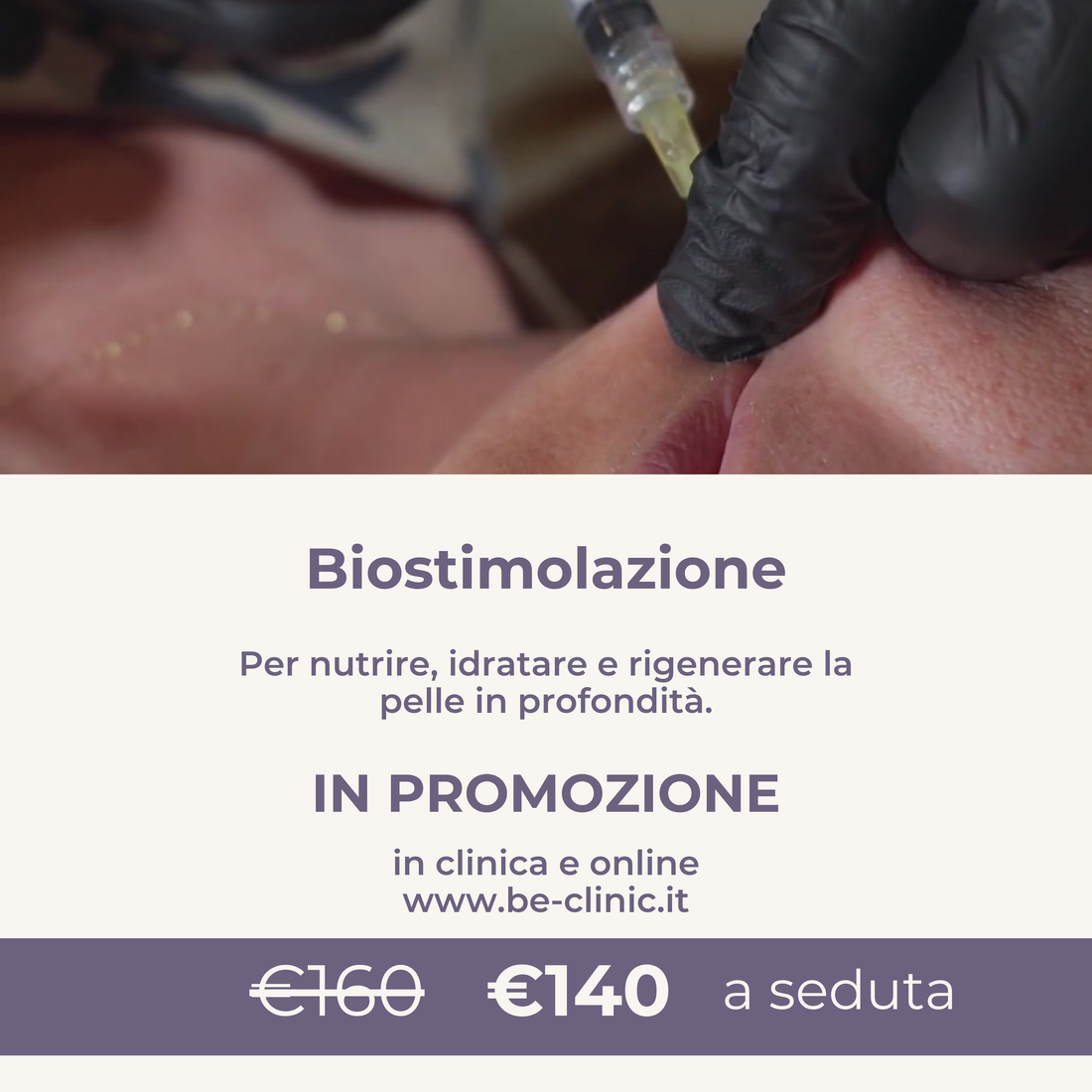 Biostimolazione