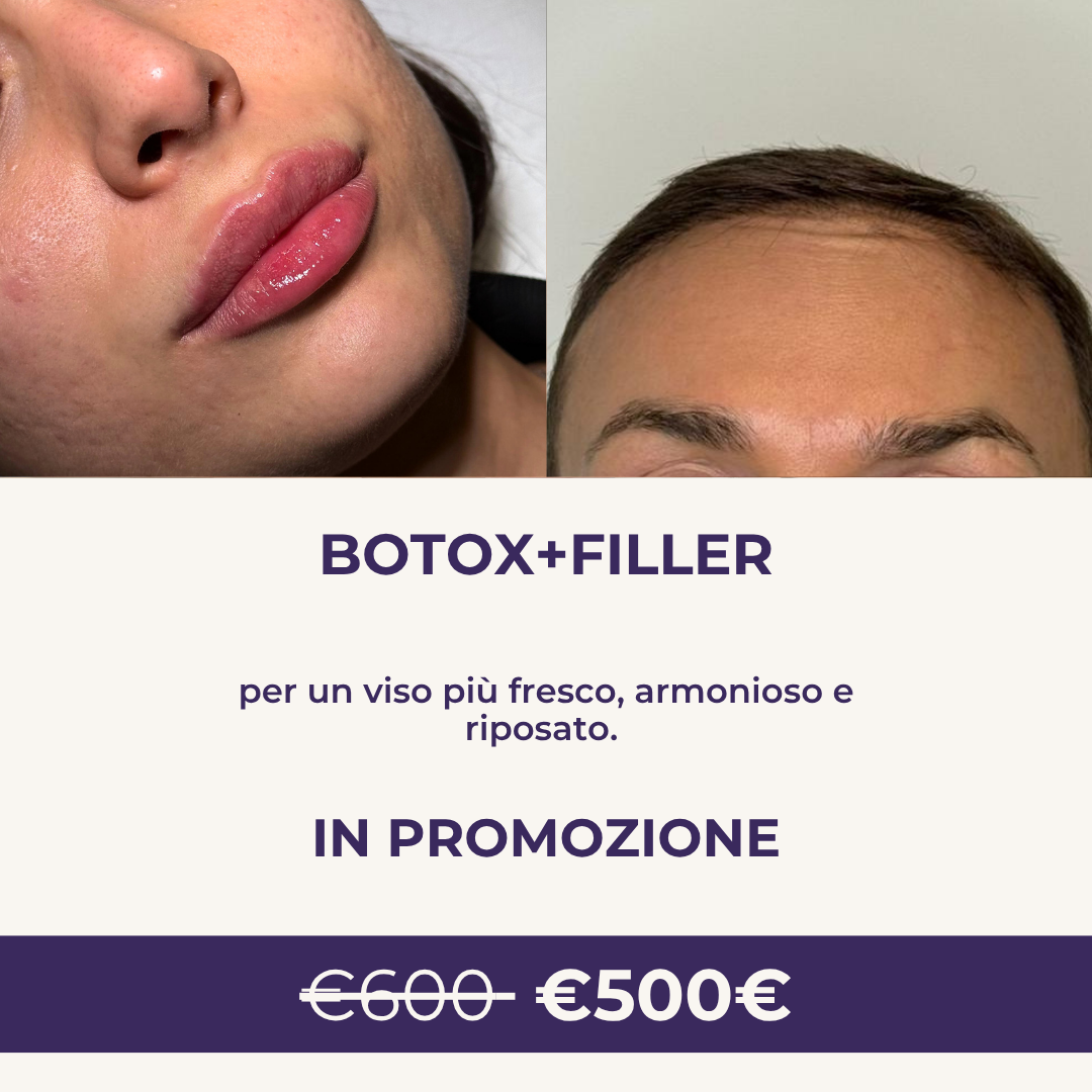 Botox + Filer