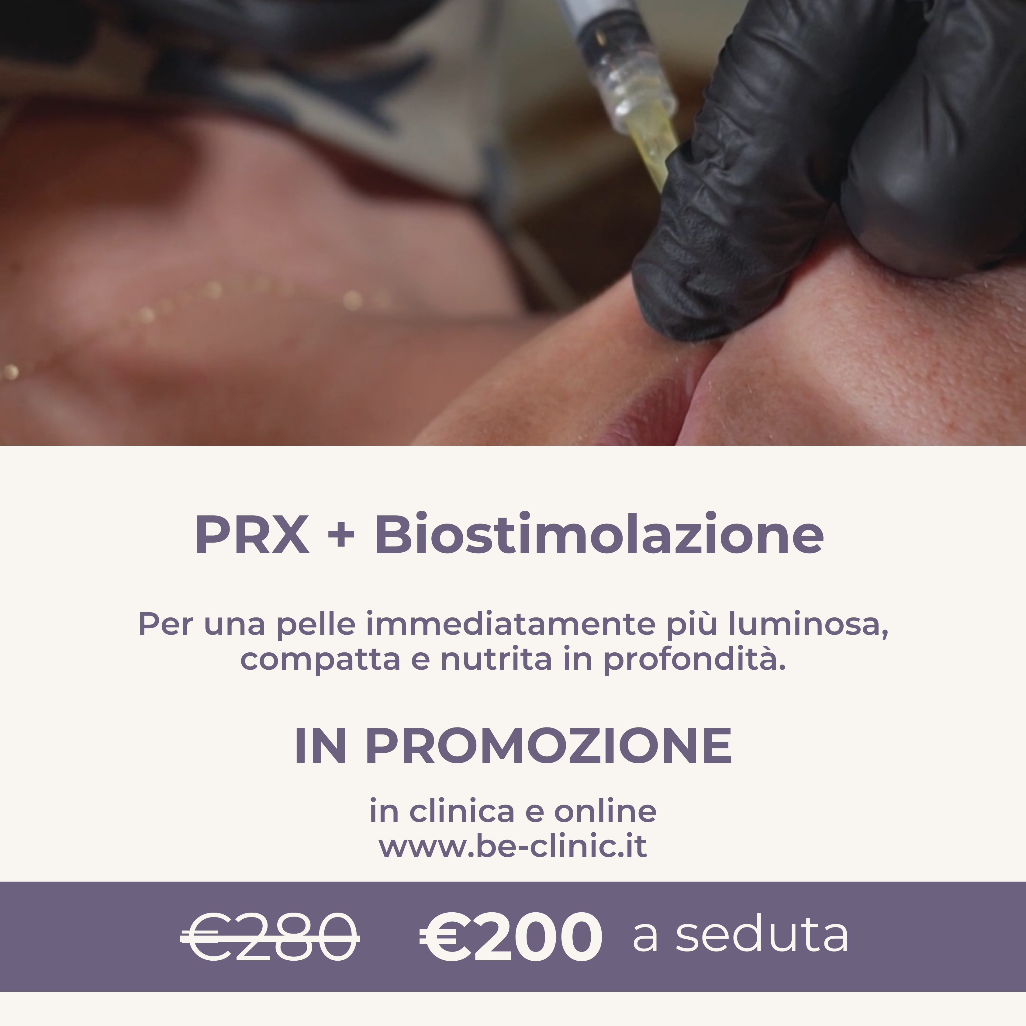 PRX + Biostimolazione